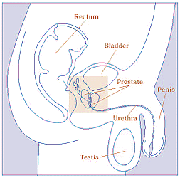 Prostate Cancer Location